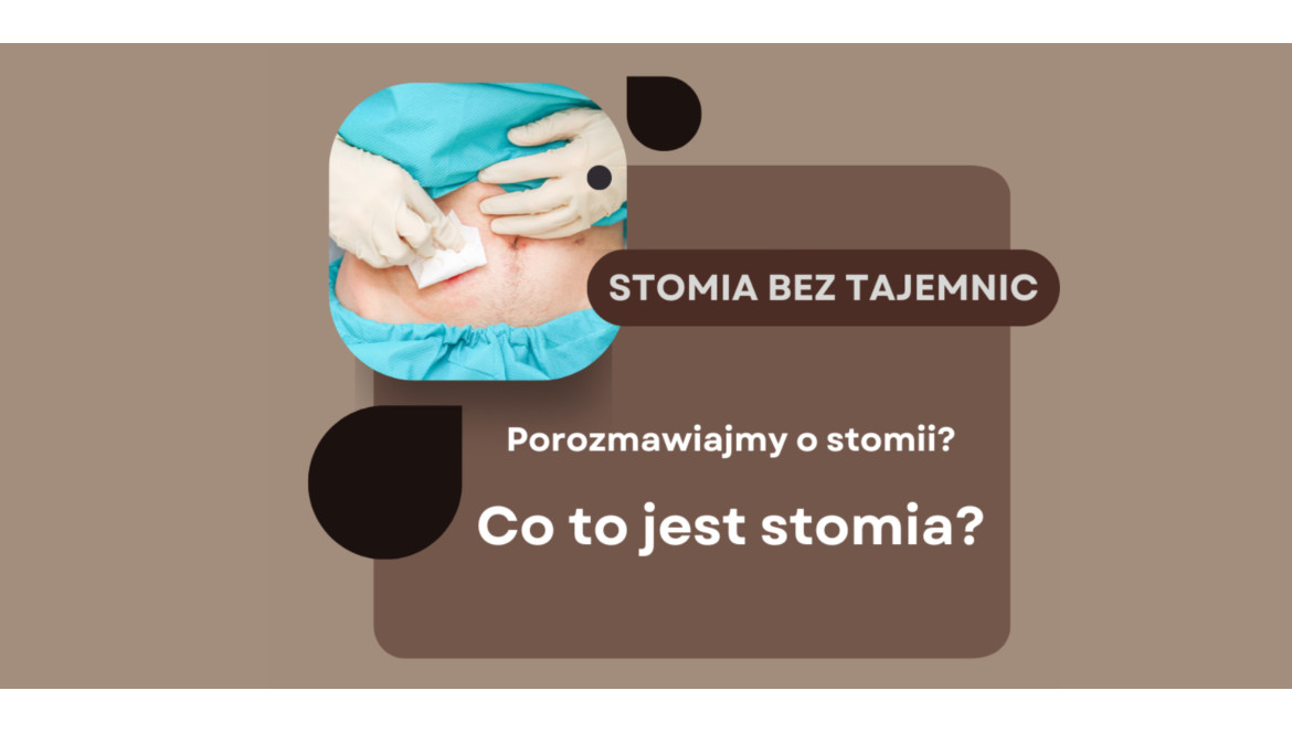 Porozmawiajmy o stomii - Stomia i jej rodzaje